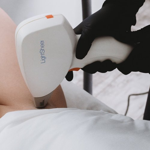 The Pros and Cons of Laser Hair Removal in London